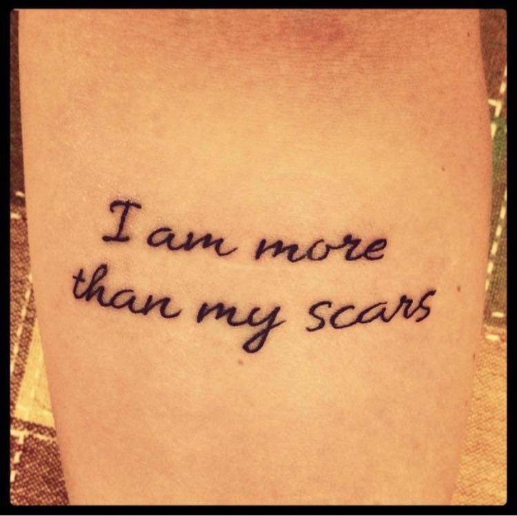 tattoo reads: I am more than my scars