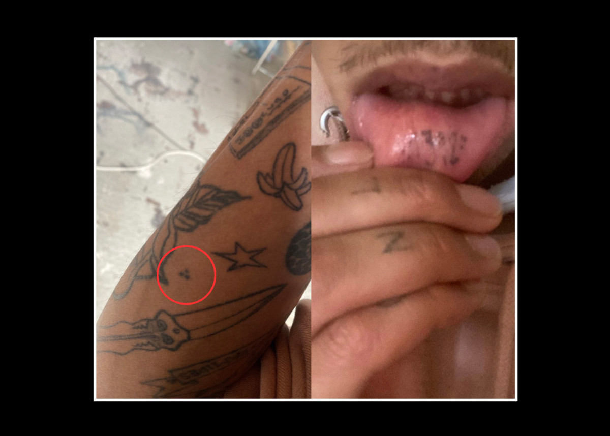 ACAB tattoos – left: three dots arranged in a triangle on someone - mort aux vaches tattoo meaning