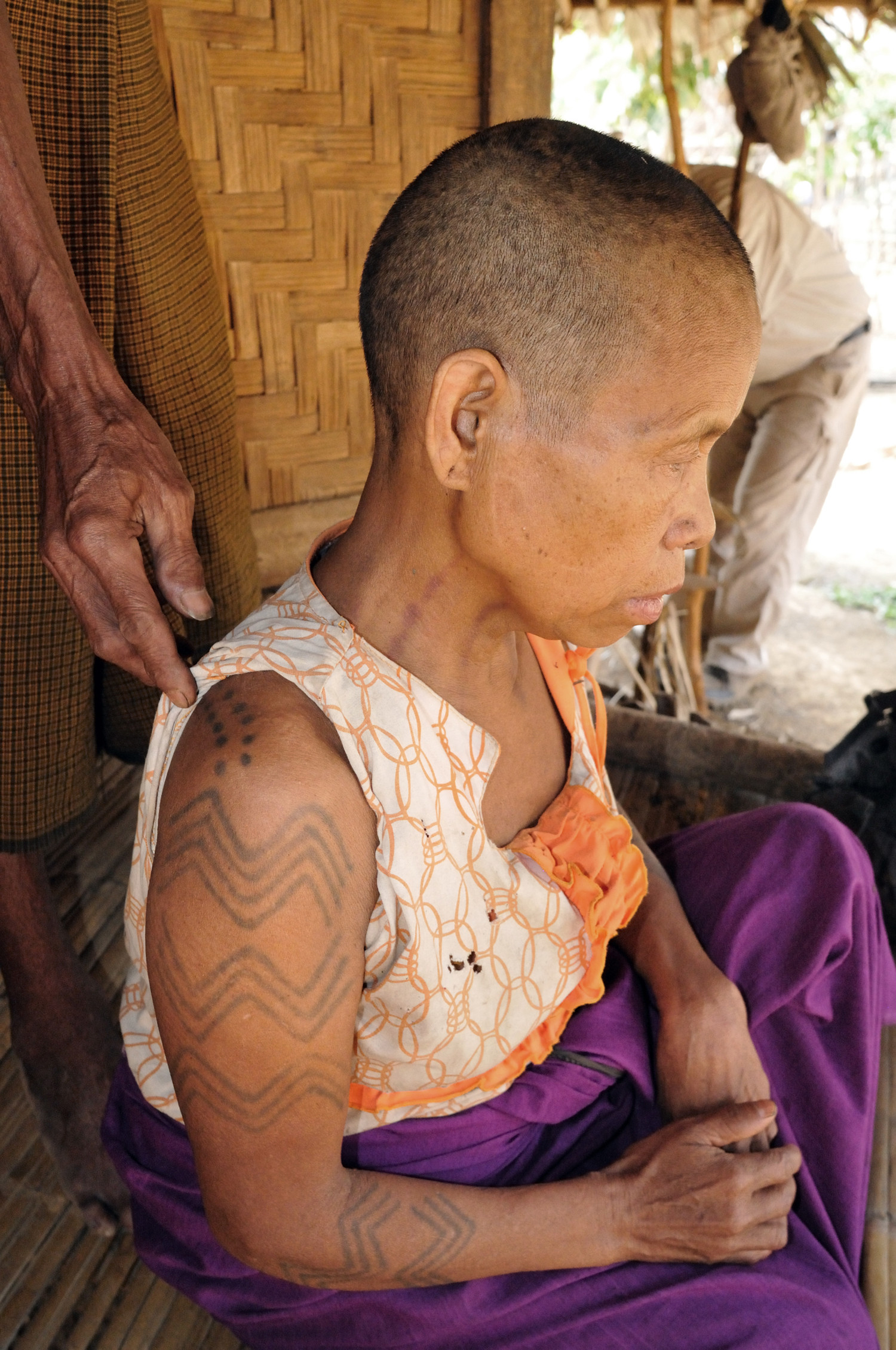 Daw Thom Kar, a Heimi Naga woman with intricate back and arm tattoos. These markings signified her passage into adulthood and readiness for marriage, reflecting cultural milestones.