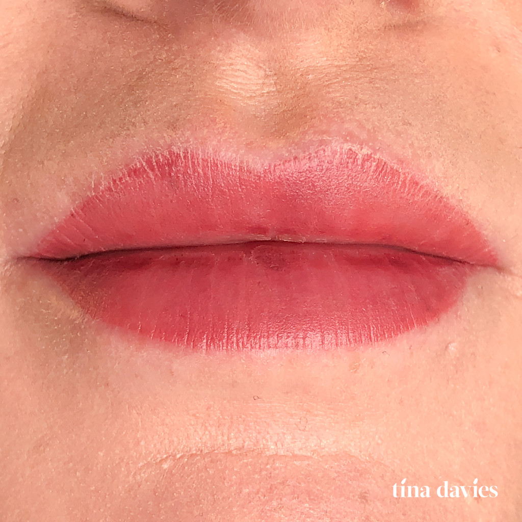 Day 3 of Lip Blush Tattoo Healing Process with Scabbing Formation