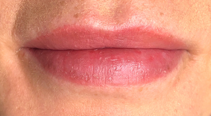 Day 10 of Lip Blush Tattoo Healing Process Showing Settled Color and Texture