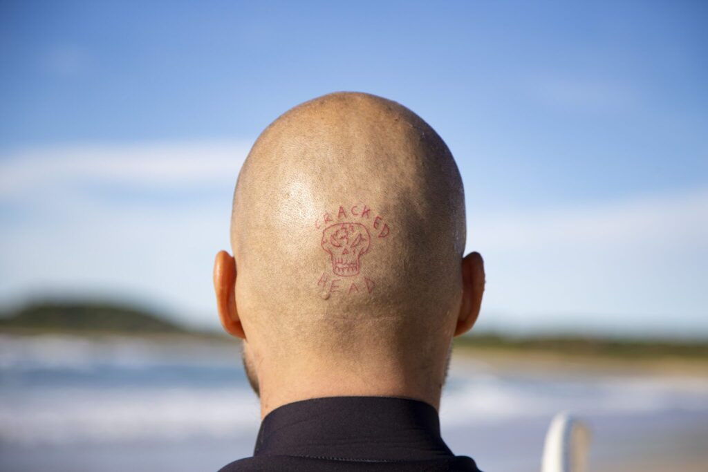 Close-up of a Saniderm bandage protecting a new tattoo on a surfer's arm while surfing.