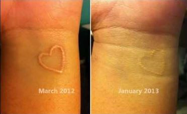 Example of a white ink geometric tattoo on the wrist, highlighting the precision and minimalist appeal of the design