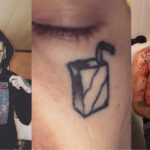 Face Tattoo Removal