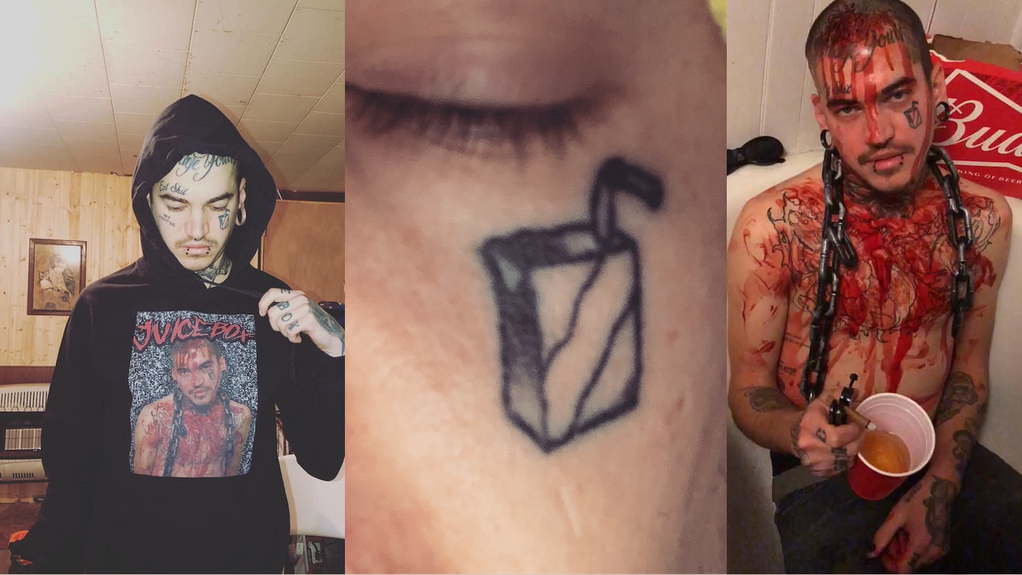 Face Tattoo Removal