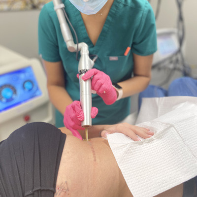 Tattoo removal risks and precautions