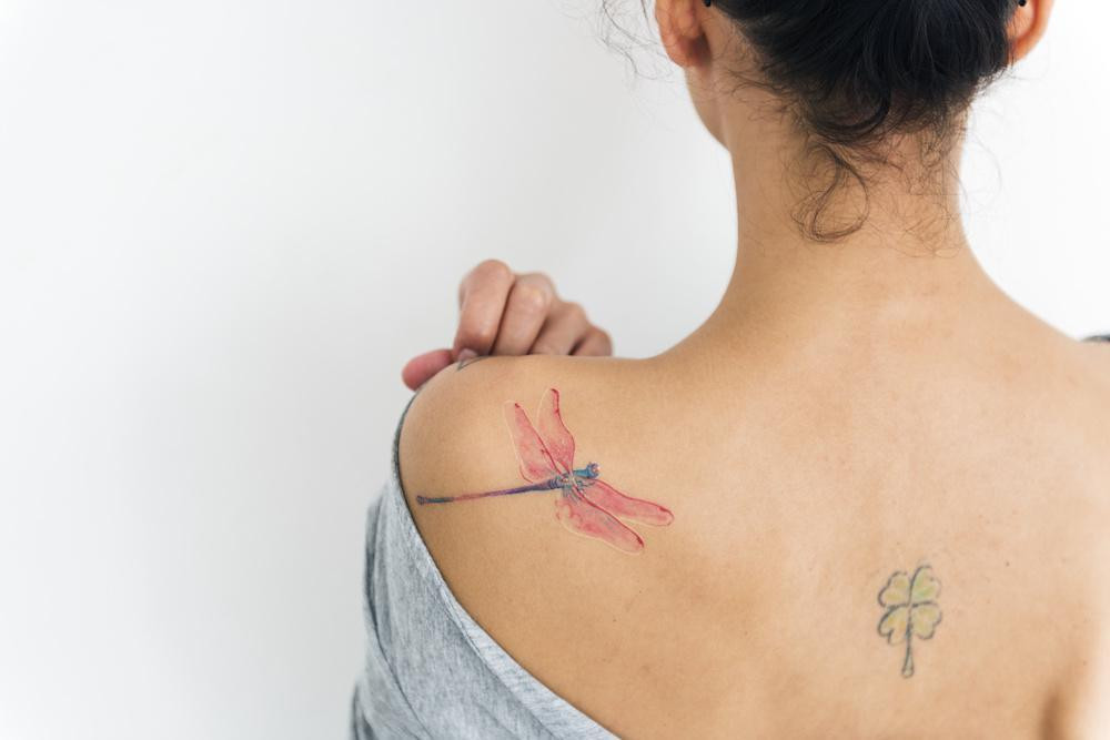 Laser tattoo removal
