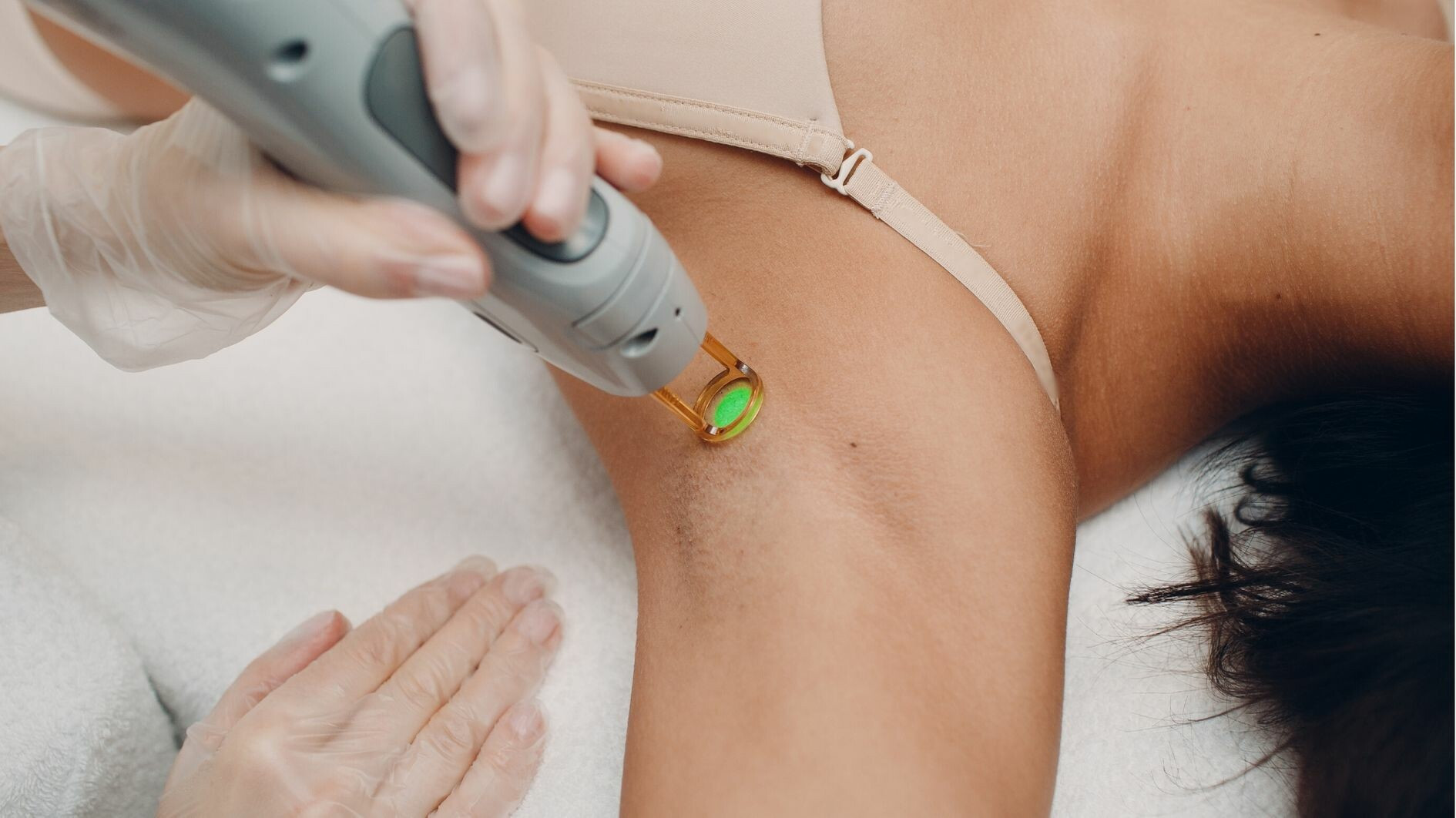 Colorful tattoo on a woman's arm, illustrating potential IPL treatment area