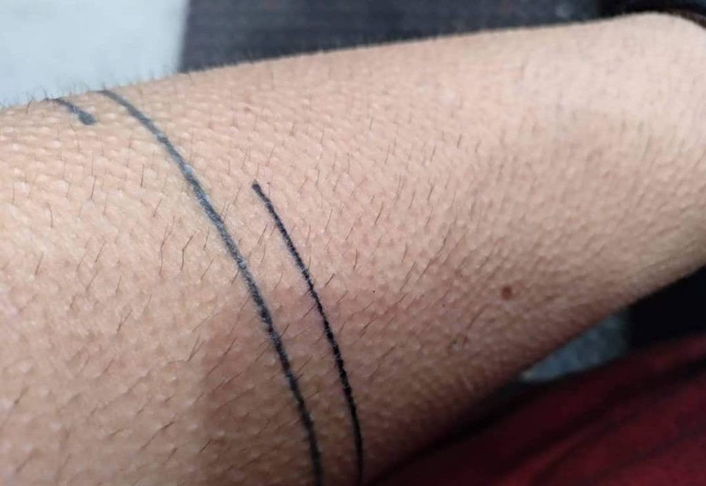 hand poke tattoo line