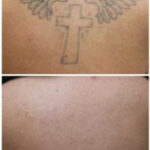 hand poked tattoo equipment