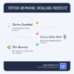 Tattoo removal healing process infographic showing timeline of immune system action, session intervals, and skin recovery stages - How long between tattoo removal sessions? infographic infographic-line-3-steps-blues-accent_colors