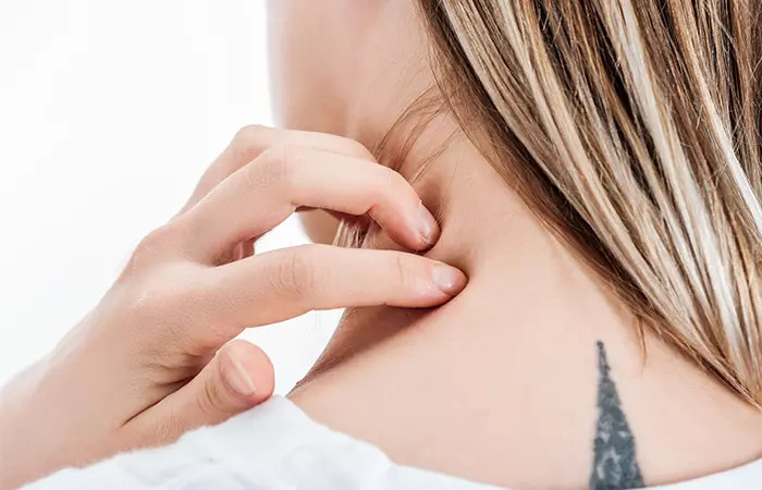 Potential allergic reactions from aloe vera on tattoos