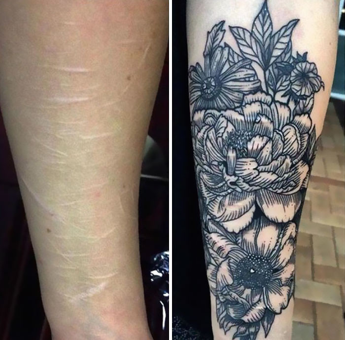 Tattoo covering a keloid scar