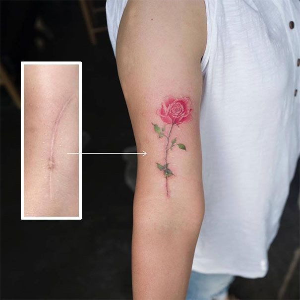 Floral tattoo covering a scar