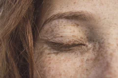Tattoo using freckles as constellation stars