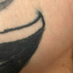 Tattoo blowout ink spreading out example.