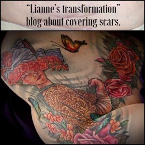 tattoo over abdominal surgery scar