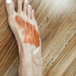 Applying moisturizer to skin to prep for tattoo coverup