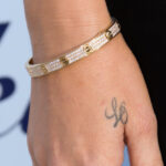 Khloe Kardashian's tattoo removal