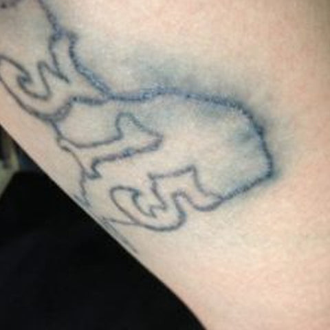 Example of a tattoo blowout with blurred lines and ink spread
