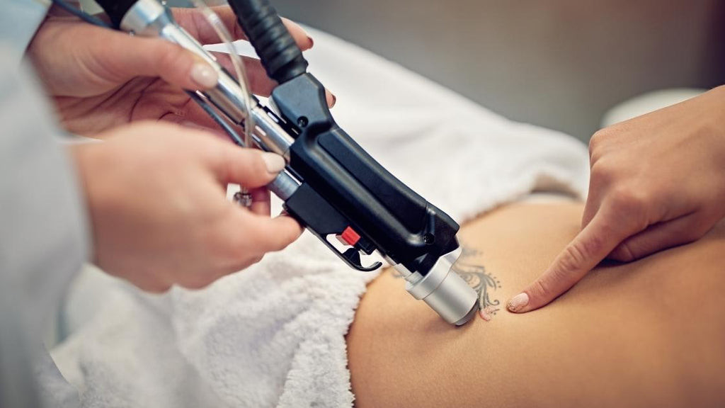 A professional busy removing a tattoo with a laser machine.