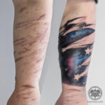 Floral Tattoo Over Scars
