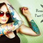 Selective tattoo ink removal using advanced laser technology