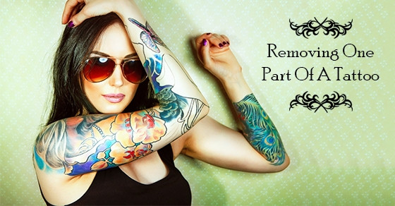 Selective tattoo ink removal using advanced laser technology