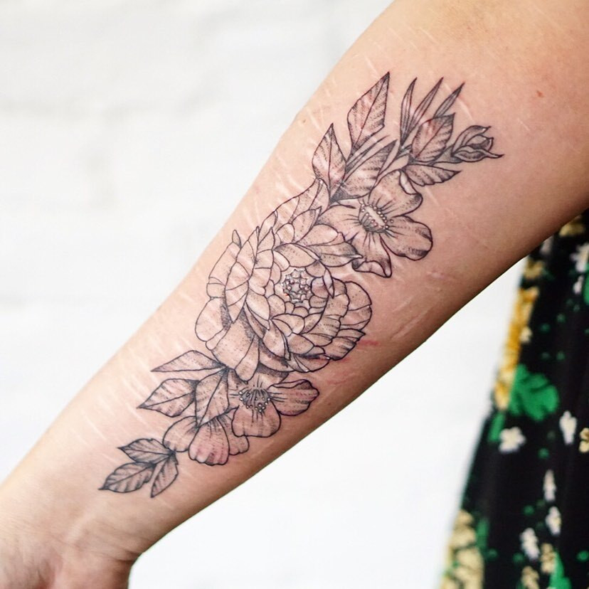 Geometric tattoo covering scars with intricate line work