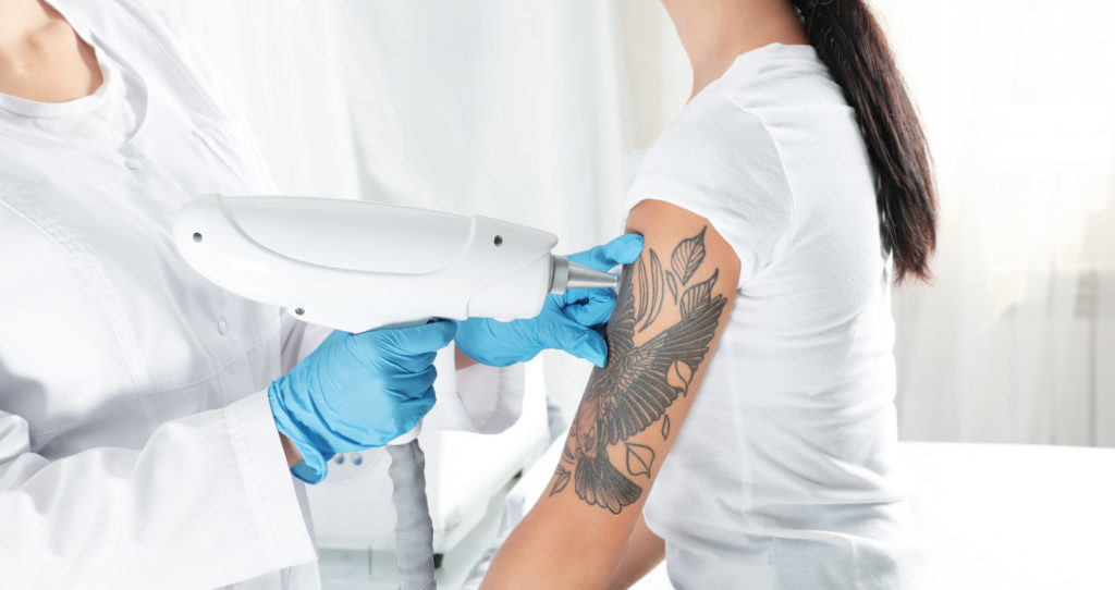 Laser tattoo removal process