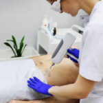 laser tattoo removal training