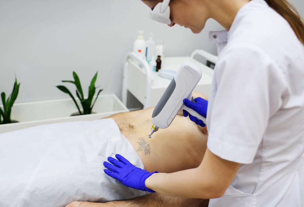 laser tattoo removal training