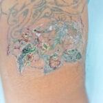 Itchy Tattoo