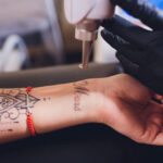 Laser tattoo removal in progress, using advanced technology for safe ink removal.