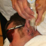 tattoo removalist training