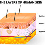Layers of the human skin, highlighting epidermis, dermis, and hypodermis