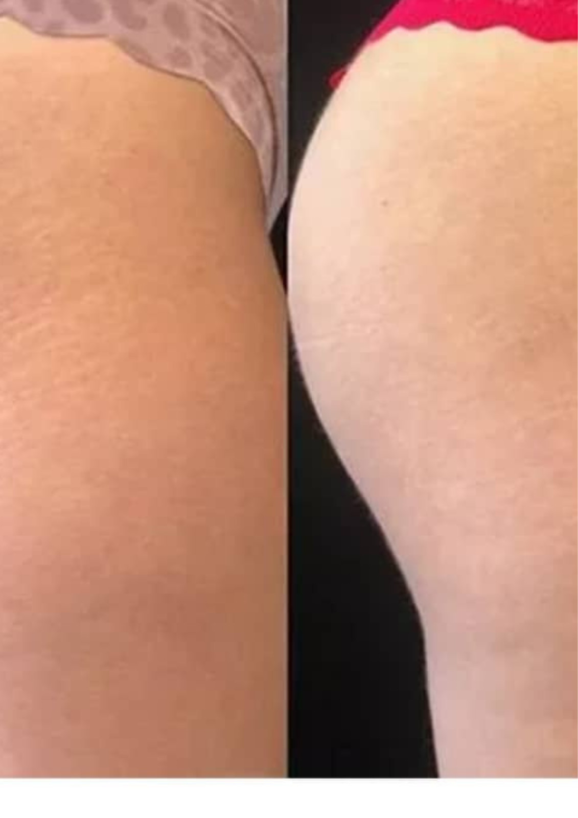 best skin-tone tatoo ink