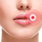 Fever blister after lips tattoo