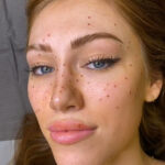 Woman getting freckles tattooed on to her face
