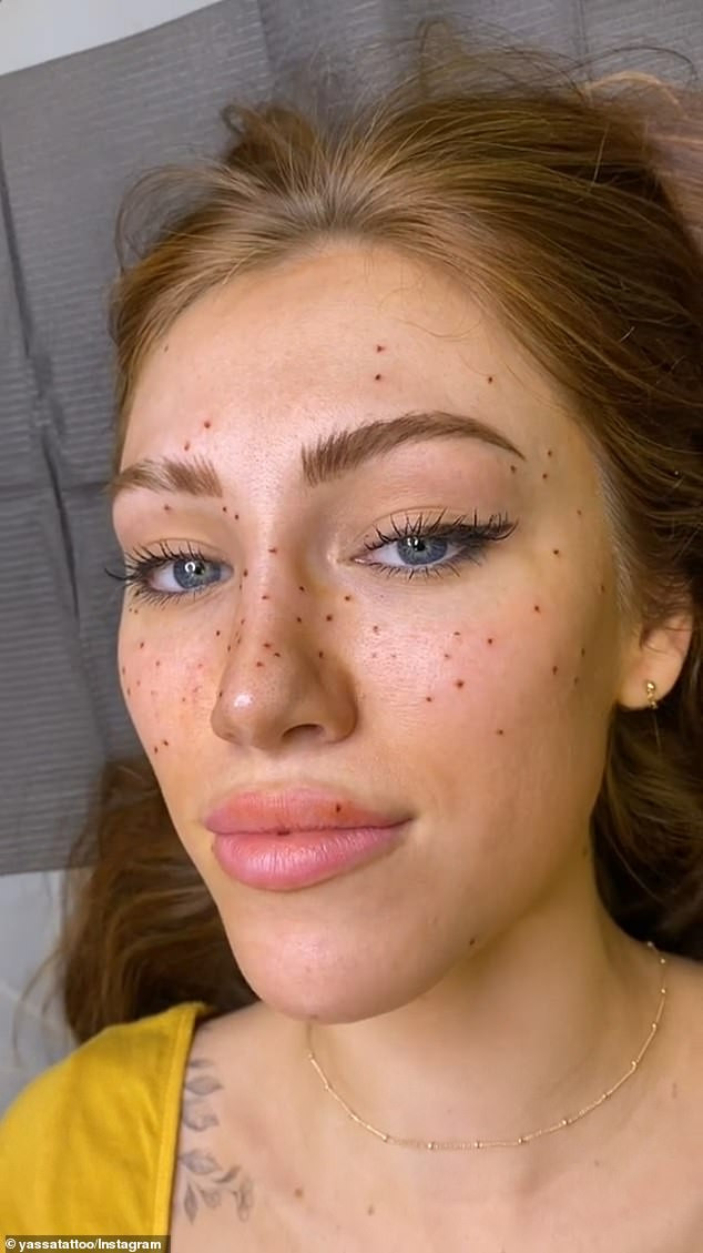 Woman getting freckles tattooed on to her face