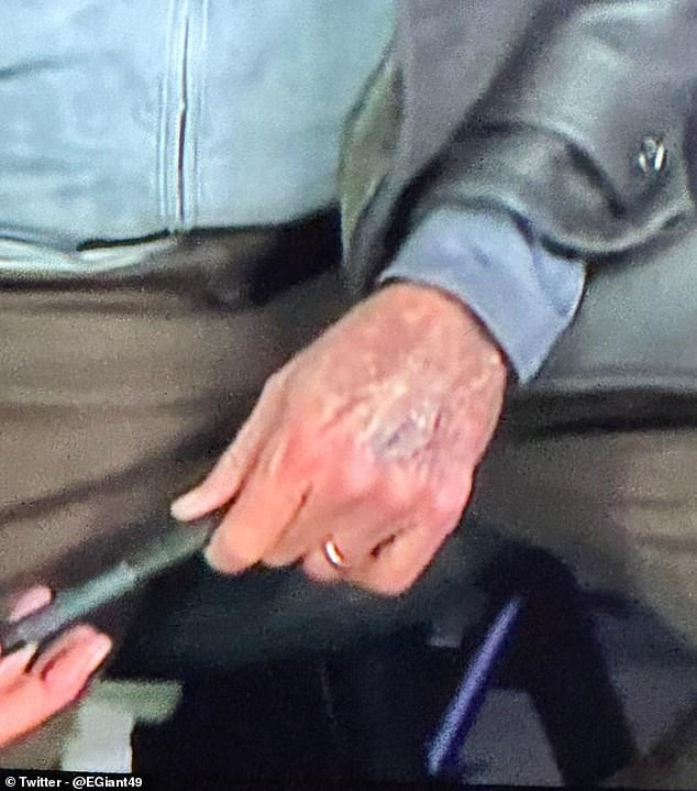 Close up picture of Cris Collinsworth, hands possibly discolored due to weather or other condition