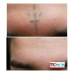 Stick and poke cross tattoo on a man's face