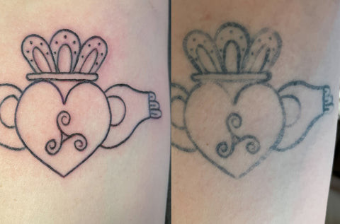 Stick and poke tattoo on arm with simple design