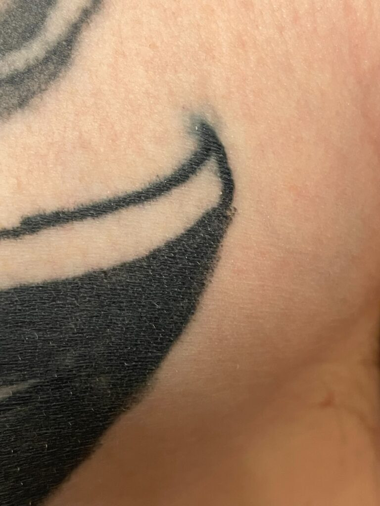 Tattoo blowout ink spreading out example