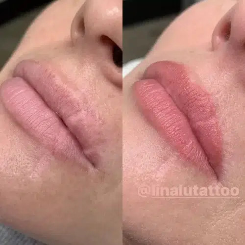 tattoo cover up scar on leg
