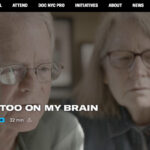 Neurologist being filmed during the creation of the 'A Tattoo on My Brain' documentary, showcasing behind-the-scenes insights