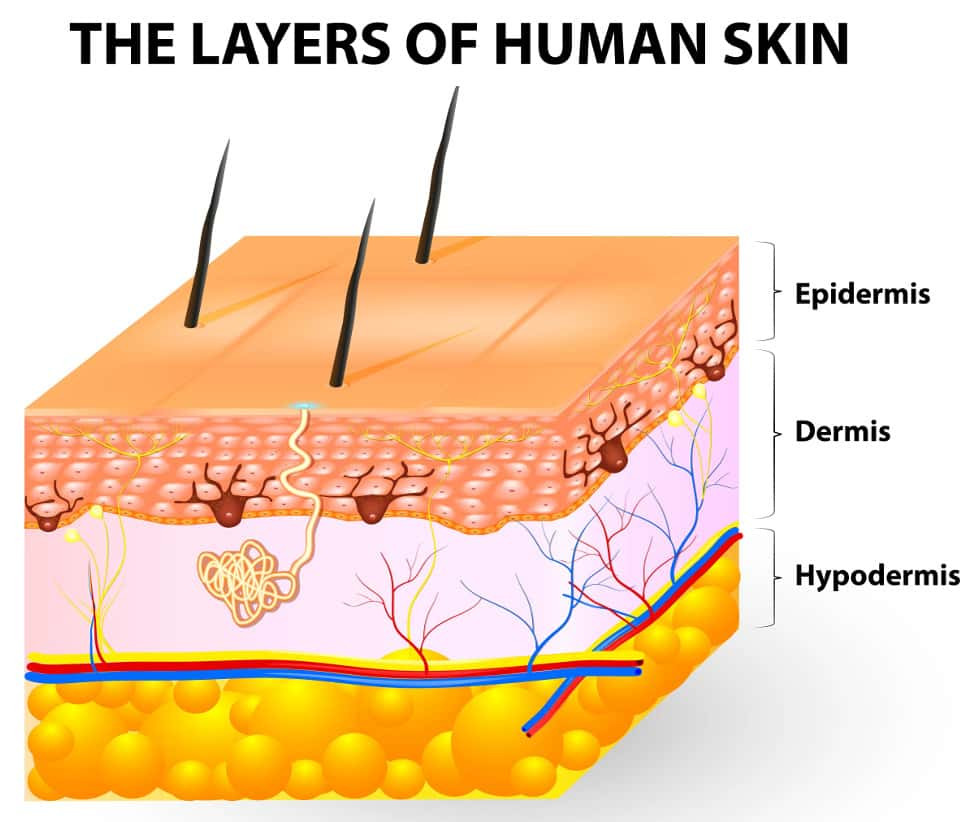 Layers of skin depicting epidermis, dermis, and hypodermis